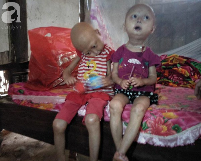 Tuyên Quang: 2 chị em gái mắc bệnh lạ khiến đầu, cổ bị nghẹo tựa người ngoài hành tinh khiến ai nhìn cũng xót xa - Ảnh 6.