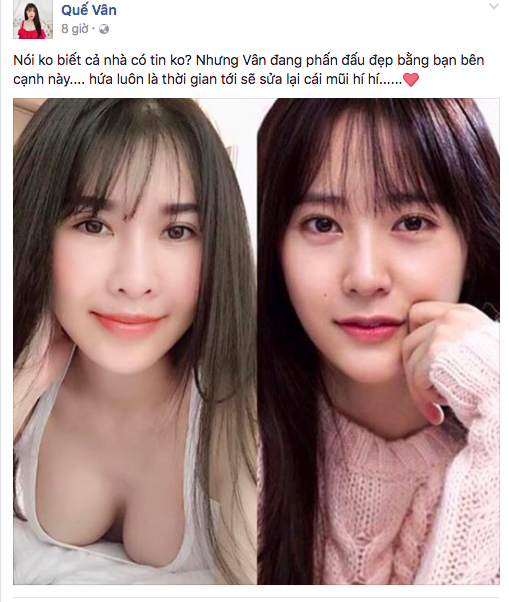 Từng mê Krystal nay lại đổi sang Song Hye Kyo, Quế Vân hễ thích ai là đi sửa mũi cho giống bằng được người ấy - Ảnh 2.