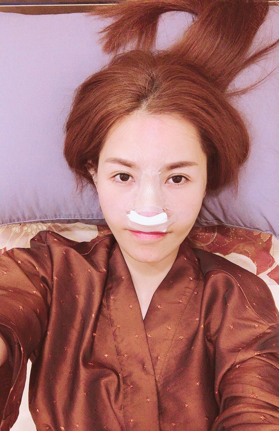 Cận cảnh gương mặt của Quế Vân sau cuộc phẫu thuật mũi lần thứ 6 - Ảnh 2.