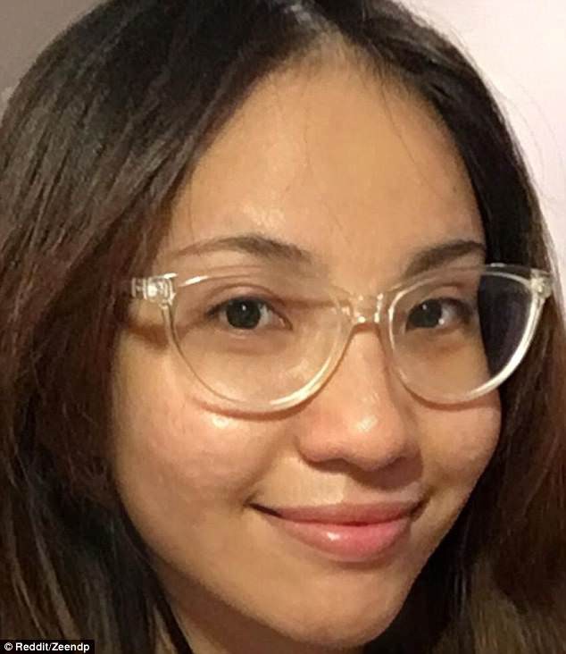 Cô gái người Việt lên cả báo nước ngoài vì trị khỏi mụn một cách thần kỳ - Ảnh 3.
