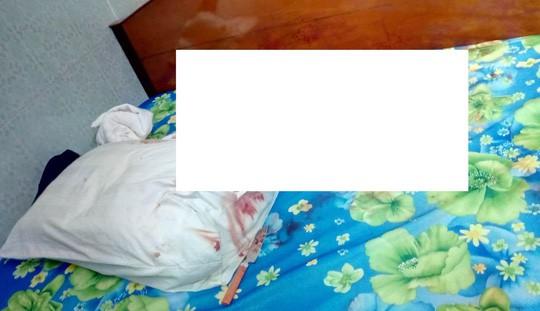 Nghi vấn nữ b&aacute;c sĩ bị người y&ecirc;u cũ s&aacute;t hại bất th&agrave;nh - Ảnh 1.
