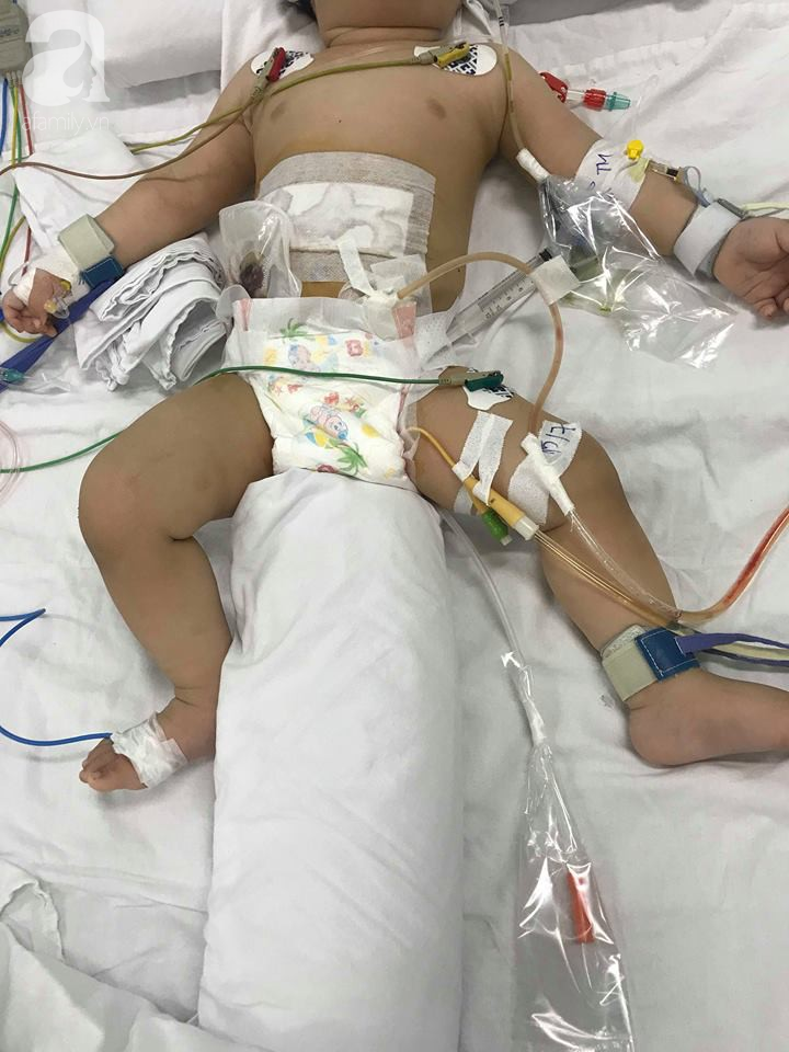 TP.HCM: Bé trai 11 tháng tuổi bị mẹ ruột dùng dao đâm nhiều nhát vào bụng nguy kịch - Ảnh 1. TP.HCM: Bé trai 11 tháng tuổi bị mẹ ruột dùng dao đâm nhiều nhát vào bụng nguy kịch - Ảnh 1.