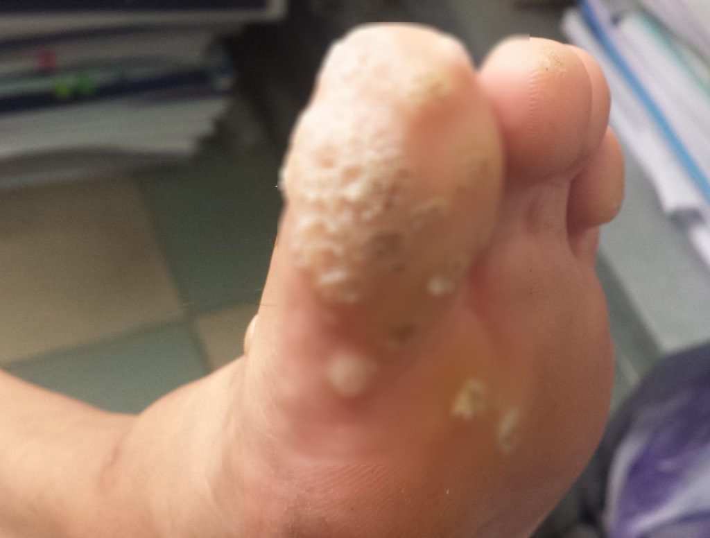 Mưa gió liên tục, cẩn thận đề phòng ngay những căn bệnh viêm nhiễm ở chân - Ảnh 1.