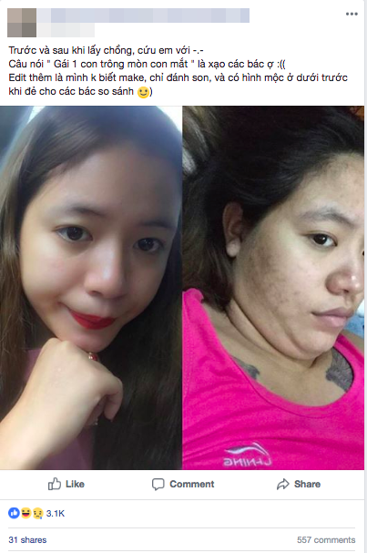 Tăng 10kg sau sinh không giảm, cơ thể sồ sề mặt chi chít vết thâm, bà mẹ trẻ tuyên bố: Gái một con trông mòn con mắt là giả dối! - Ảnh 1.