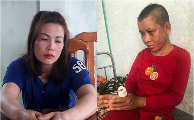 Vụ cô gái trẻ tố bị tra tấn: Đối tượng từng là tay anh chị trong giới giang hồ? - Ảnh 1.