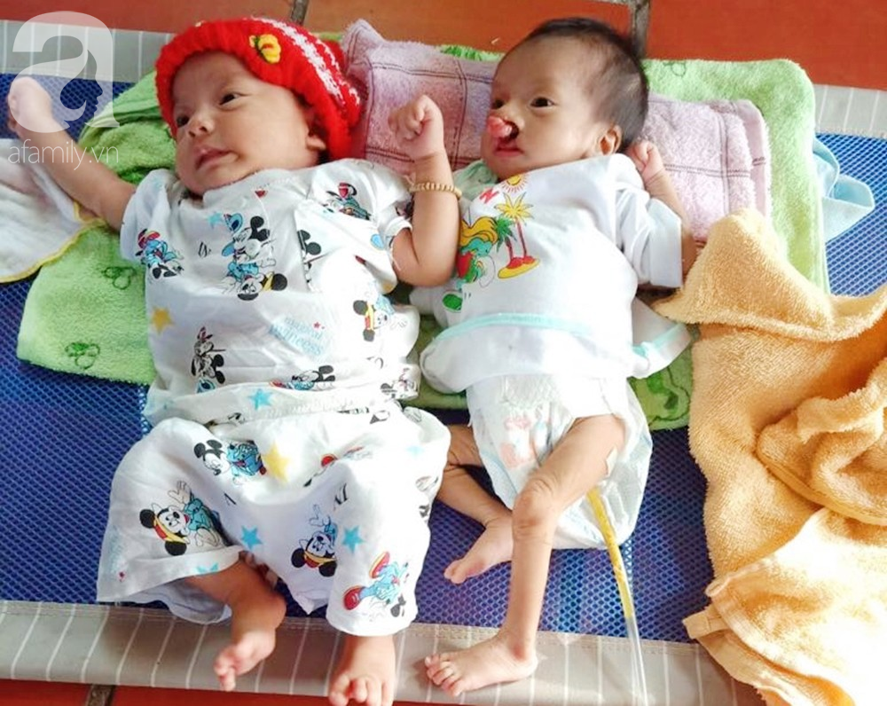 Xót cảnh bé trai 2 tháng tuổi bị suy dinh dưỡng, nặng chỉ 2 ký mà mẹ nghèo không đủ tiền để đưa lên Sài Gòn chữa bệnh - Ảnh 12. Xót cảnh bé trai 2 tháng tuổi bị suy dinh dưỡng, nặng chỉ 2 ký mà mẹ nghèo không đủ tiền để đưa lên Sài Gòn chữa bệnh - Ảnh 12.