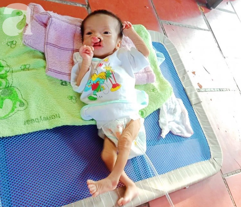 Xót cảnh bé trai 2 tháng tuổi bị suy dinh dưỡng, nặng chỉ 2 ký mà mẹ nghèo không đủ tiền để đưa lên Sài Gòn chữa bệnh - Ảnh 3. Xót cảnh bé trai 2 tháng tuổi bị suy dinh dưỡng, nặng chỉ 2 ký mà mẹ nghèo không đủ tiền để đưa lên Sài Gòn chữa bệnh - Ảnh 3.