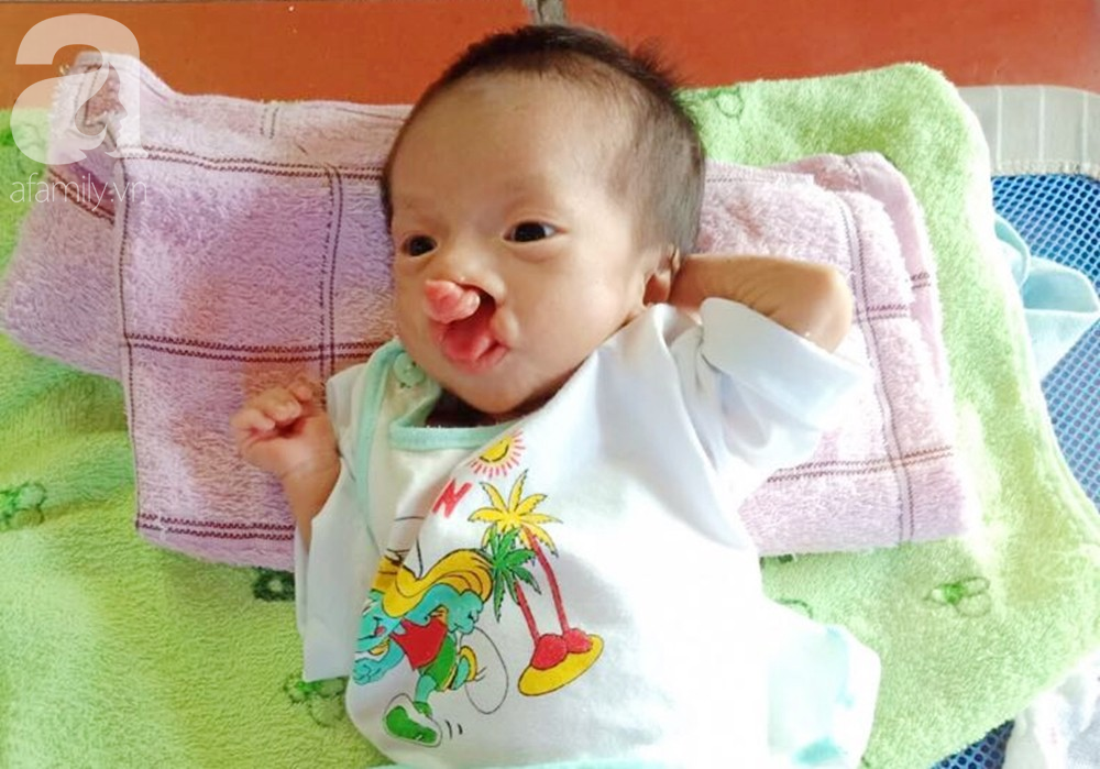 Xót cảnh bé trai 2 tháng tuổi bị suy dinh dưỡng, nặng chỉ 2 ký mà mẹ nghèo không đủ tiền để đưa lên Sài Gòn chữa bệnh - Ảnh 5. Xót cảnh bé trai 2 tháng tuổi bị suy dinh dưỡng, nặng chỉ 2 ký mà mẹ nghèo không đủ tiền để đưa lên Sài Gòn chữa bệnh - Ảnh 5.