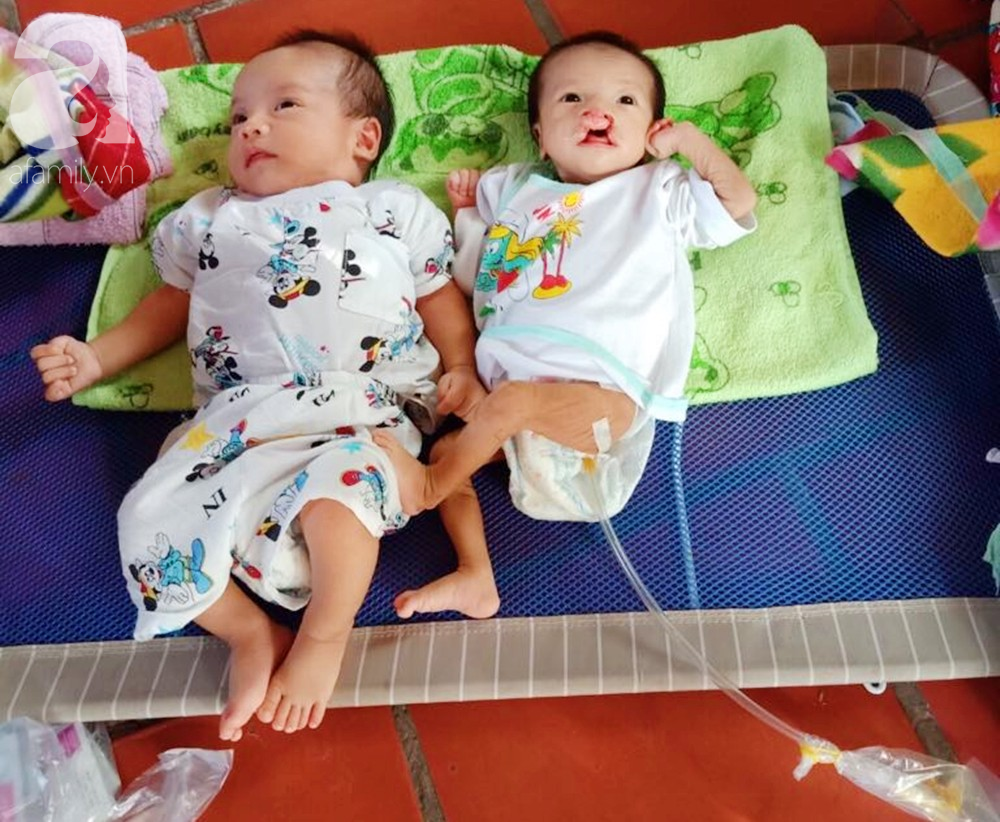 Xót cảnh bé trai 2 tháng tuổi bị suy dinh dưỡng, nặng chỉ 2 ký mà mẹ nghèo không đủ tiền để đưa lên Sài Gòn chữa bệnh - Ảnh 7. Xót cảnh bé trai 2 tháng tuổi bị suy dinh dưỡng, nặng chỉ 2 ký mà mẹ nghèo không đủ tiền để đưa lên Sài Gòn chữa bệnh - Ảnh 7.