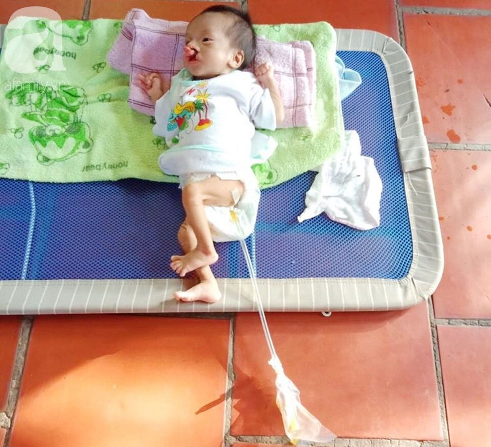 Xót cảnh bé trai 2 tháng tuổi bị suy dinh dưỡng, nặng chỉ 2 ký mà mẹ nghèo không đủ tiền để đưa lên Sài Gòn chữa bệnh - Ảnh 10. Xót cảnh bé trai 2 tháng tuổi bị suy dinh dưỡng, nặng chỉ 2 ký mà mẹ nghèo không đủ tiền để đưa lên Sài Gòn chữa bệnh - Ảnh 10.
