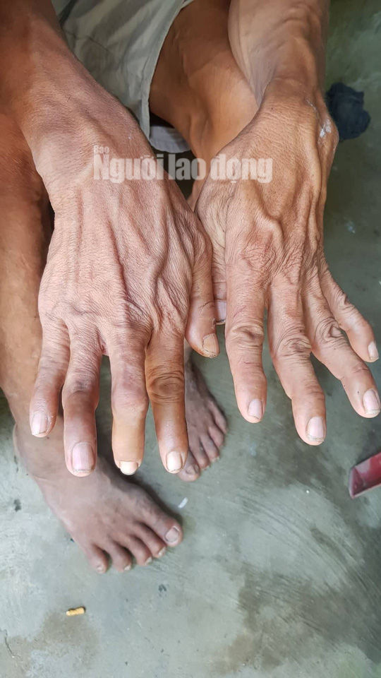 Cuộc sống khó khăn của người khổng lồ cao hơn 2,1 m ở miền Tây - Ảnh 3.