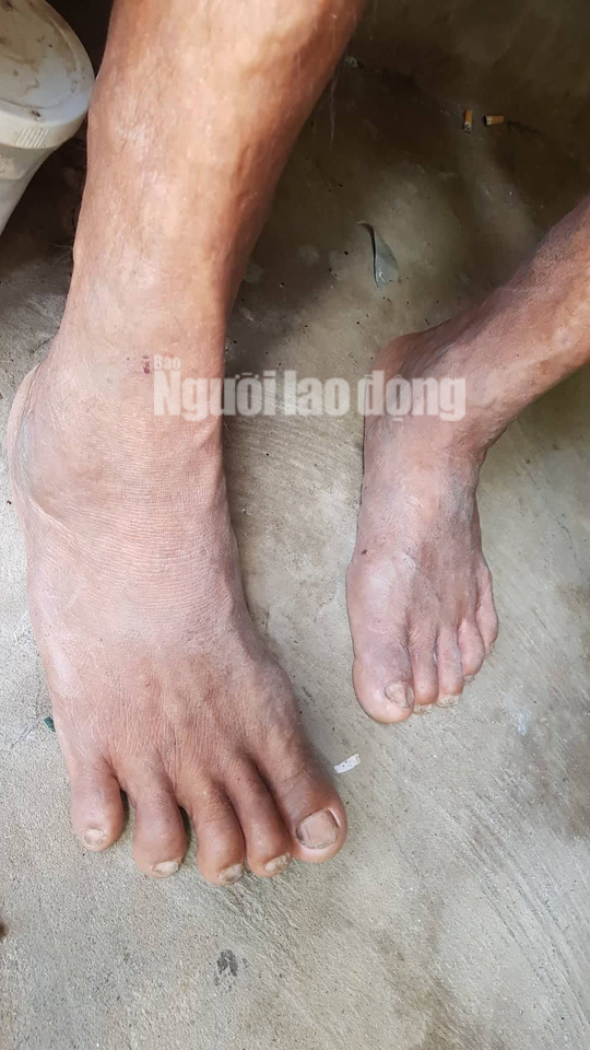 Cuộc sống khó khăn của người khổng lồ cao hơn 2,1 m ở miền Tây - Ảnh 4.