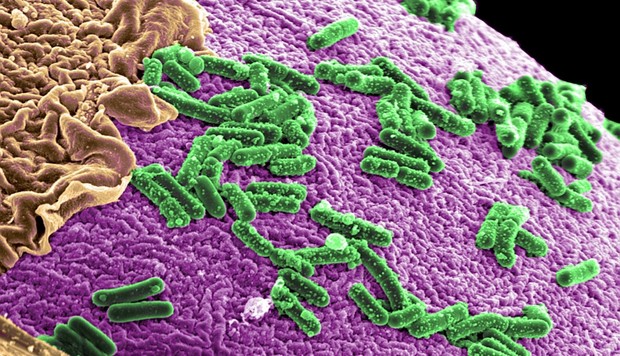 Tìm hiểu về Salmonella - hung thủ gây chứng ngộ độc kinh khủng nhất - Ảnh 2.