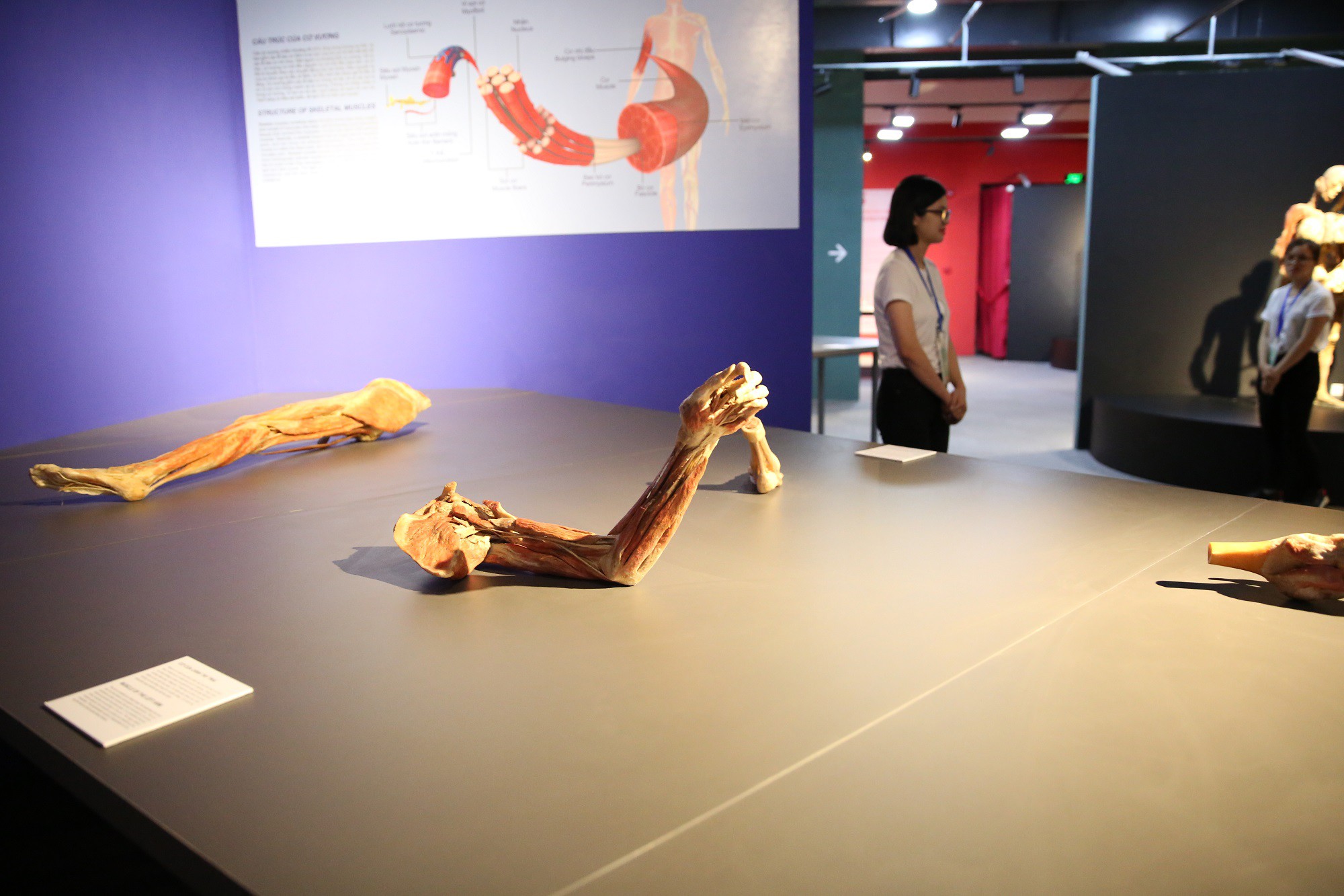 Triển lãm cơ thể và nội tạng của xác người thật được nhựa hóa ở Sài Gòn gây tranh cãi - Ảnh 2.