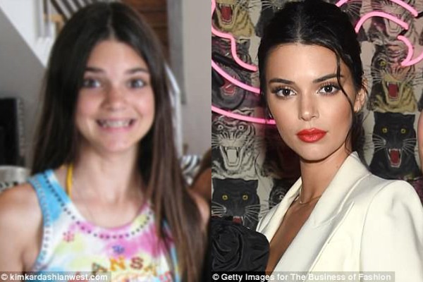 Tự tin khoe ảnh qu&aacute; khứ, 3 chị em nh&agrave; Kardashian/Jenner liền bị soi nhan sắc dao k&eacute;o - Ảnh 3.