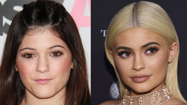 Kylie Jenner than phiền vì vòng 1 to gấp ba lần sau khi sinh con - Ảnh 7.