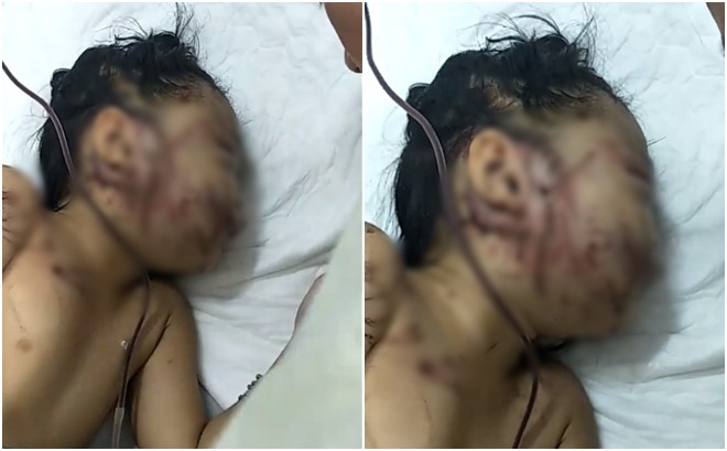 Tai nạn ở Quảng Nam: Bé gái sống sót trên xe rước dâu liên tục gọi mẹ- Ảnh 1.