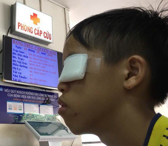 D&ugrave;ng thuốc đầu que di&ecirc;m l&agrave;m ph&aacute;o, b&eacute; trai bị hỏng mắt - Ảnh 1.