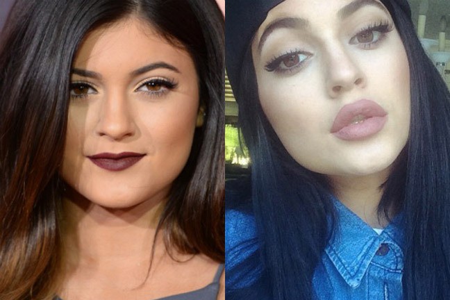 5 sự thay đổi cho thấy Kylie Jenner từ người đẹp thị phi trở nên nhu mì hơn khi yêu và lên chức mẹ - Ảnh 1.