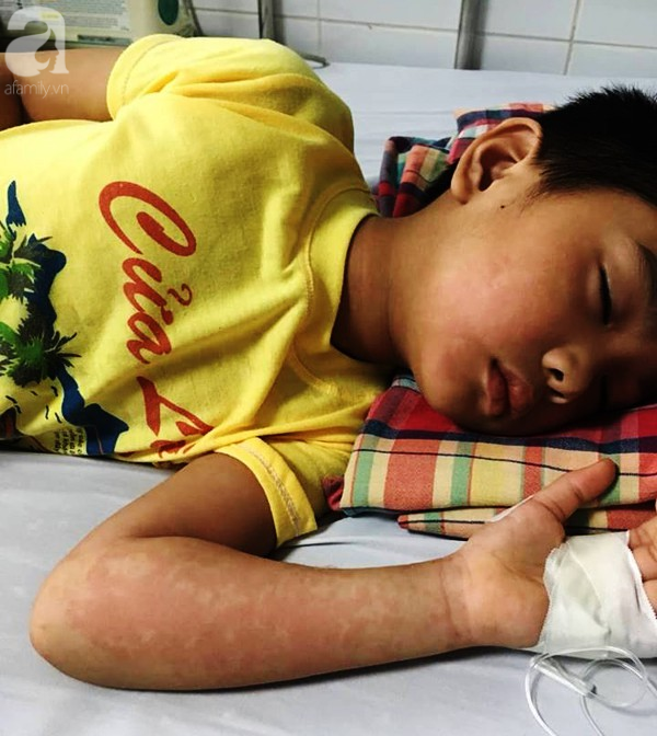 Hà Nội: Bé trai 7 tuổi đang khoẻ mạnh bỗng hôn mê vì suy đa tạng, nhiễm trùng máu sau trận sốt cao - Ảnh 1.