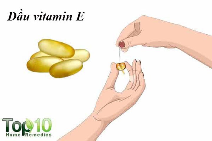Các cách đơn giản điều trị chứng khô mũi - Ảnh 5.