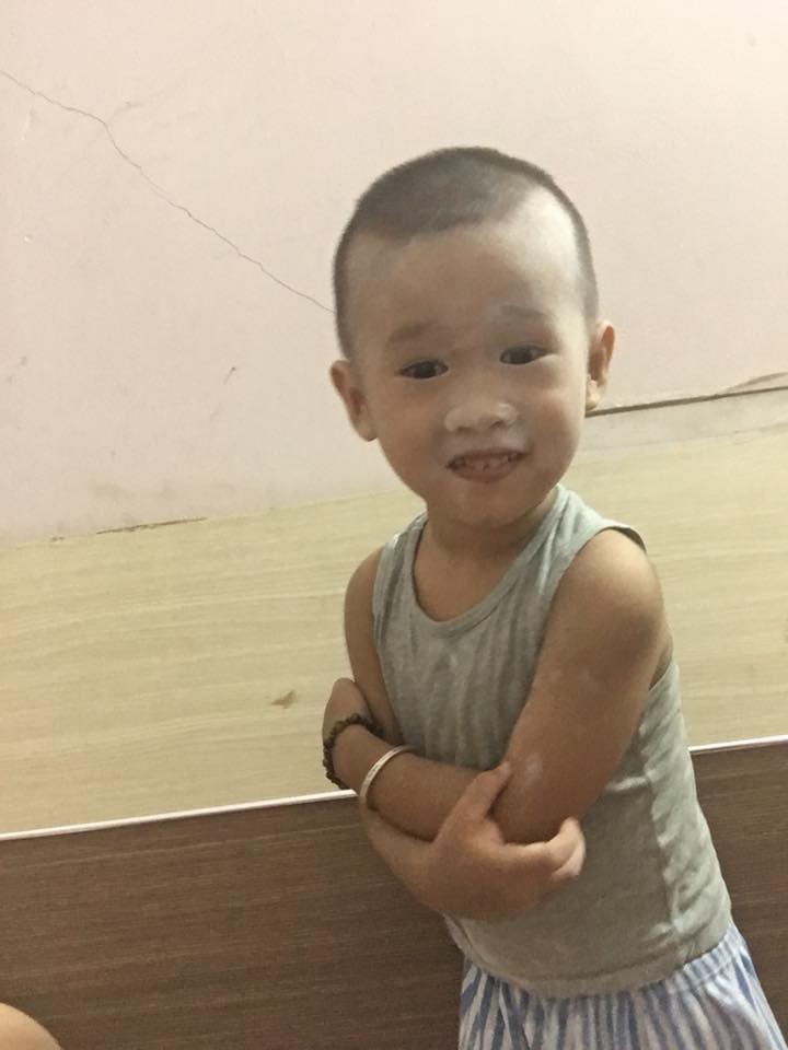 Đang tắm cho con trai lớn, mẹ trẻ trở ra ngó con trai nhỏ thì thấy cảnh tượng hãi hùng trước mắt - Ảnh 5. Đang tắm cho con trai lớn, mẹ trẻ trở ra ngó con trai nhỏ thì thấy cảnh tượng hãi hùng trước mắt - Ảnh 5.