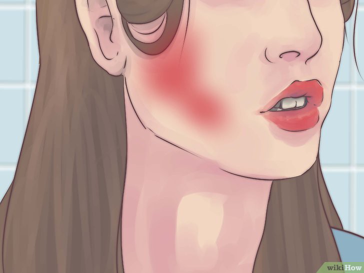 Hay bị ê buốt răng miệng thì đây chính là những cách giúp giảm bớt tình trạng này hiệu quả - Ảnh 5.