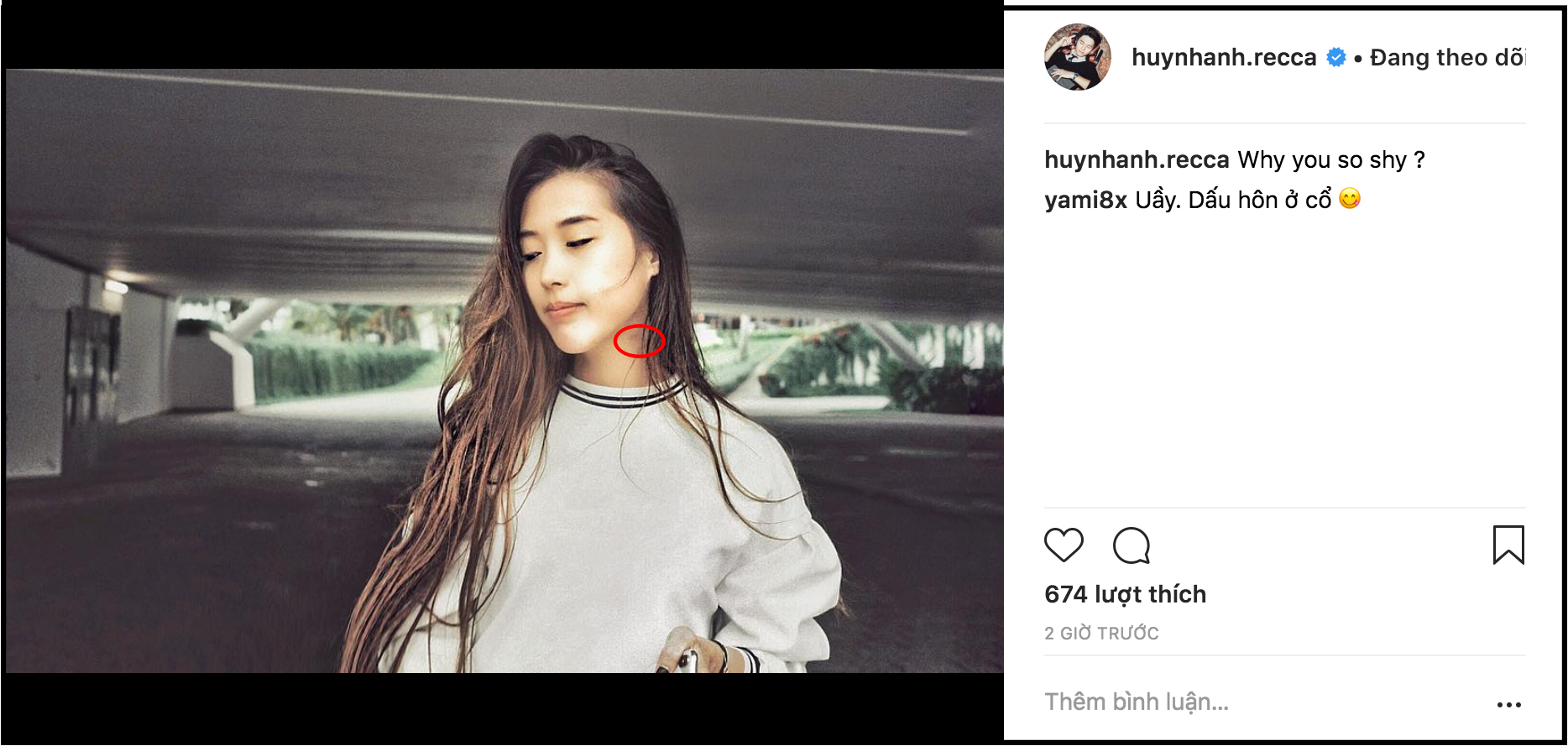 Tình mới Huỳnh Anh liên tục bị soi vết bầm khó hiểu trên cổ trong loạt ảnh mới do bạn trai tự tay chụp - Ảnh 2. Tình mới Huỳnh Anh liên tục bị soi vết bầm khó hiểu trên cổ trong loạt ảnh mới do bạn trai tự tay chụp - Ảnh 2.