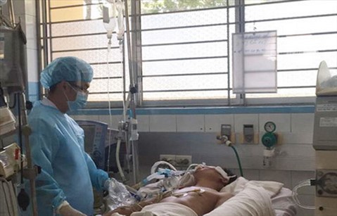 Đ&aacute;nh đuổi ch&oacute; nh&agrave; khi bị cắn, người đ&agrave;n &ocirc;ng 35 tuổi tử vong - Ảnh 1.