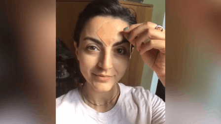 Thử d&ugrave;ng miếng d&aacute;n x&oacute;a nếp nhăn thay v&igrave; ti&ecirc;m botox, c&ocirc; n&agrave;ng n&agrave;y nhận được kết quả mỹ m&atilde;n - Ảnh 3.
