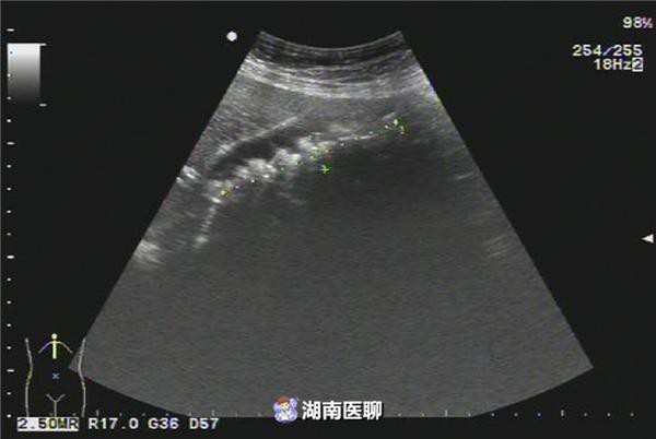 Nếu là nữ giới thì cần đặc biệt ghi nhớ những điều sau để không gặp phải sự cố kinh hoàng như người phụ nữ này - Ảnh 1. Nếu là nữ giới thì cần đặc biệt ghi nhớ những điều sau để không gặp phải sự cố kinh hoàng như người phụ nữ này - Ảnh 1.