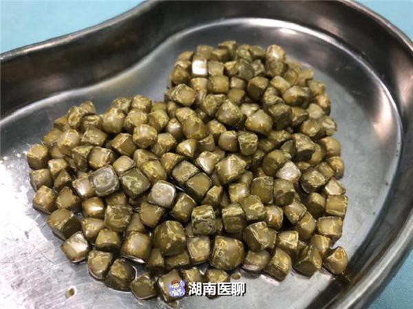 Nếu là nữ giới thì cần đặc biệt ghi nhớ những điều sau để không gặp phải sự cố kinh hoàng như người phụ nữ này - Ảnh 2. Nếu là nữ giới thì cần đặc biệt ghi nhớ những điều sau để không gặp phải sự cố kinh hoàng như người phụ nữ này - Ảnh 2.