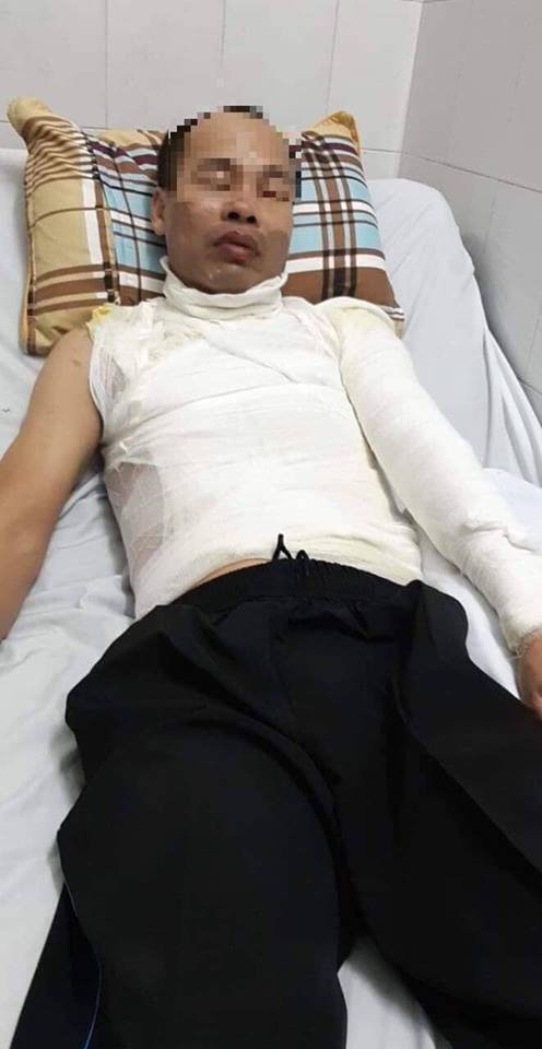 Hà nội: Đang chở con gái đi trên đường, người đàn ông bị kẻ lạ lao đến tạt a xít - Ảnh 1. Hà nội: Đang chở con gái đi trên đường, người đàn ông bị kẻ lạ lao đến tạt a xít - Ảnh 1.