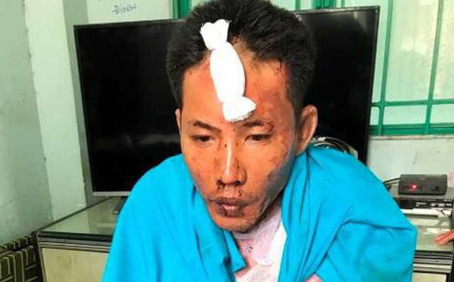 Vụ tạt xăng thi&ecirc;u sống 3 mẹ con người t&igrave;nh: B&eacute; g&aacute;i 12 tuổi đ&atilde; tử vong - Ảnh 1.