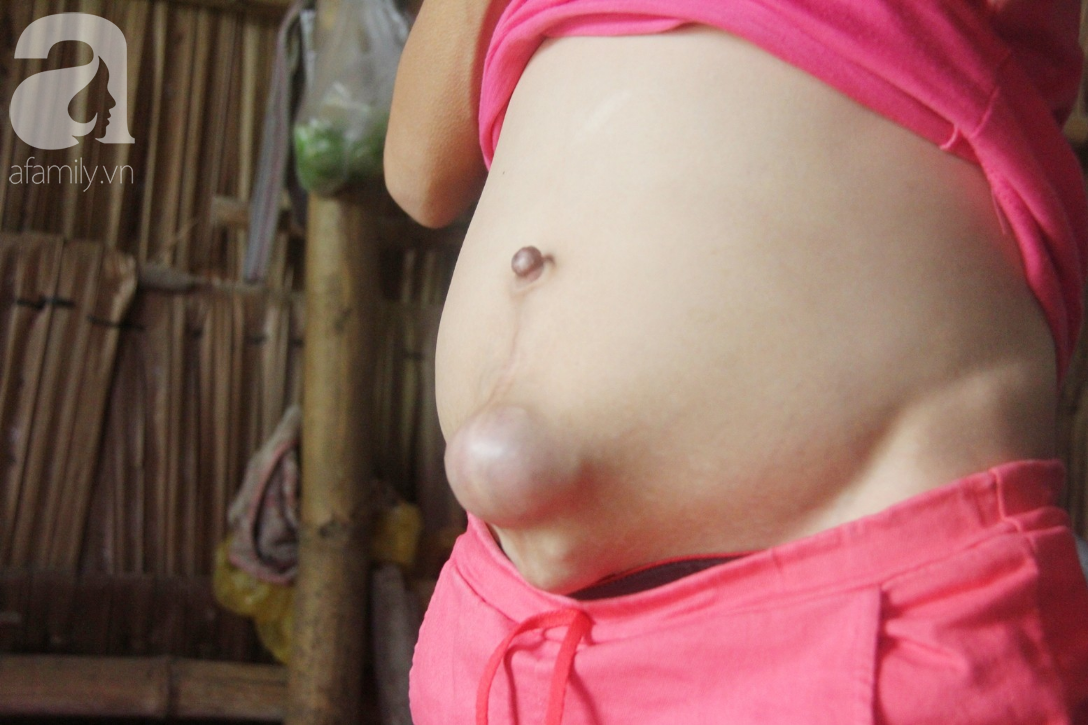 Người đàn ông trẻ chấp nhận điều tiếng, một tay chăm sóc vợ bệnh tật của người khác suốt 2 năm trời - Ảnh 6. Người đàn ông trẻ chấp nhận điều tiếng, một tay chăm sóc vợ bệnh tật của người khác suốt 2 năm trời - Ảnh 6.