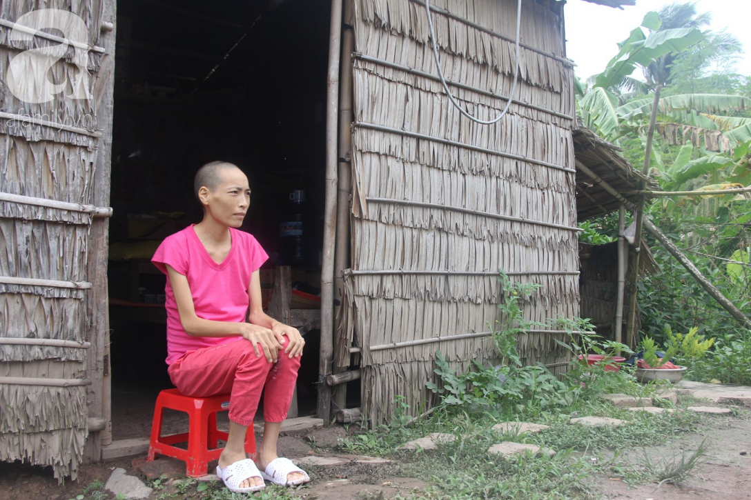 Người đàn ông trẻ chấp nhận điều tiếng, một tay chăm sóc vợ bệnh tật của người khác suốt 2 năm trời - Ảnh 7. Người đàn ông trẻ chấp nhận điều tiếng, một tay chăm sóc vợ bệnh tật của người khác suốt 2 năm trời - Ảnh 7.