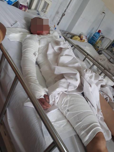 Bi kịch của người phụ nữ &ldquo;hai lần đ&ograve;&rdquo; bị chồng thi&ecirc;u sống - Ảnh 1.