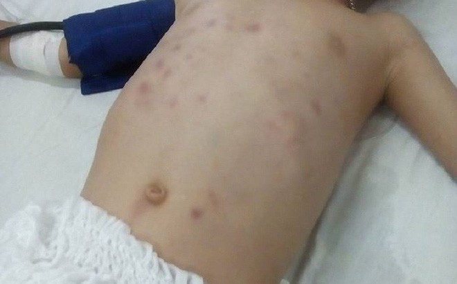Gã chồng hờ đánh vỡ ổ bụng, thủng ruột con riêng của vợ: Vì ăn vào nôn ra - Ảnh 1. Gã chồng hờ đánh vỡ ổ bụng, thủng ruột con riêng của vợ: Vì ăn vào nôn ra - Ảnh 1.