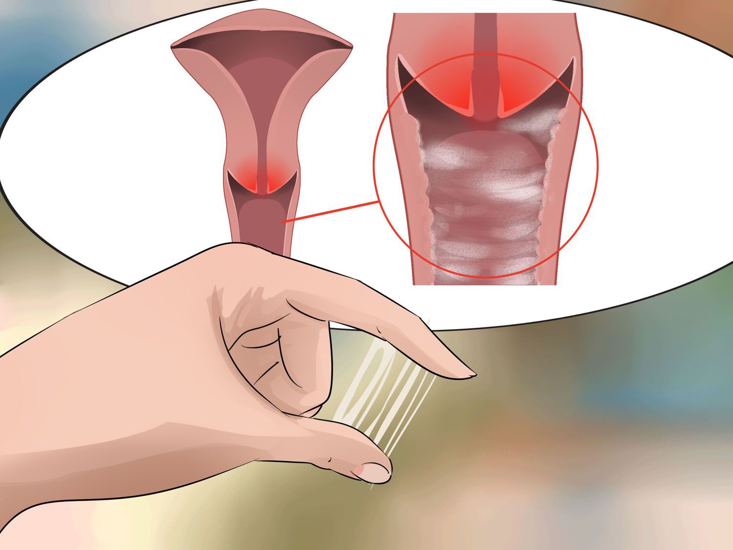 Cẩn thận với 4 kiểu viêm âm đạo con gái rất dễ gặp phải nhưng lại chủ quan xem thường - Ảnh 1. Cẩn thận với 4 kiểu viêm âm đạo con gái rất dễ gặp phải nhưng lại chủ quan xem thường - Ảnh 1.