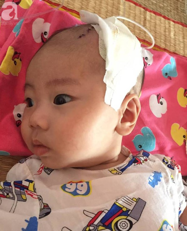 Chào đời được ít ngày, bé trai lên cơn co giật, cha mẹ đau đớn nhận hung tin từ bác sĩ - Ảnh 1.