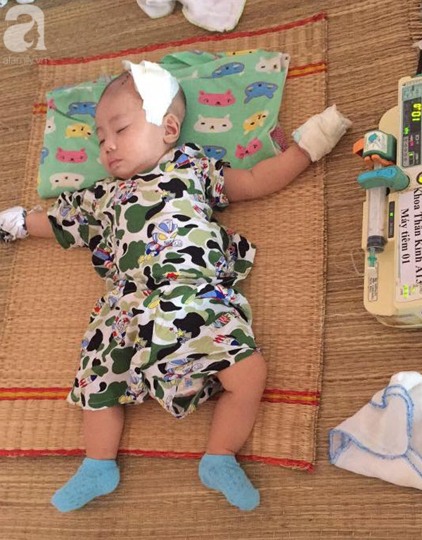 Chào đời được ít ngày, bé trai lên cơn co giật, cha mẹ đau đớn nhận hung tin từ bác sĩ - Ảnh 2.