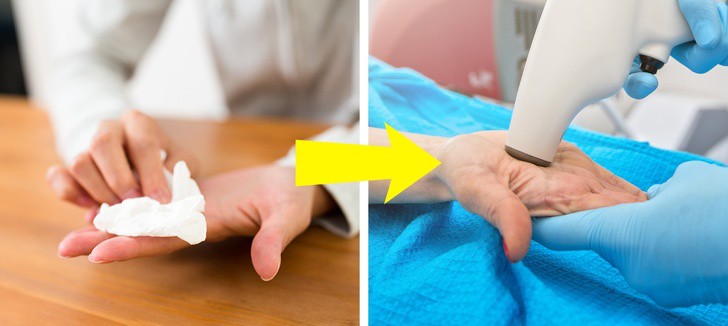 5 dấu hiệu cảnh báo những căn bệnh nguy hiểm thông qua đôi bàn tay của bạn - Ảnh 2.