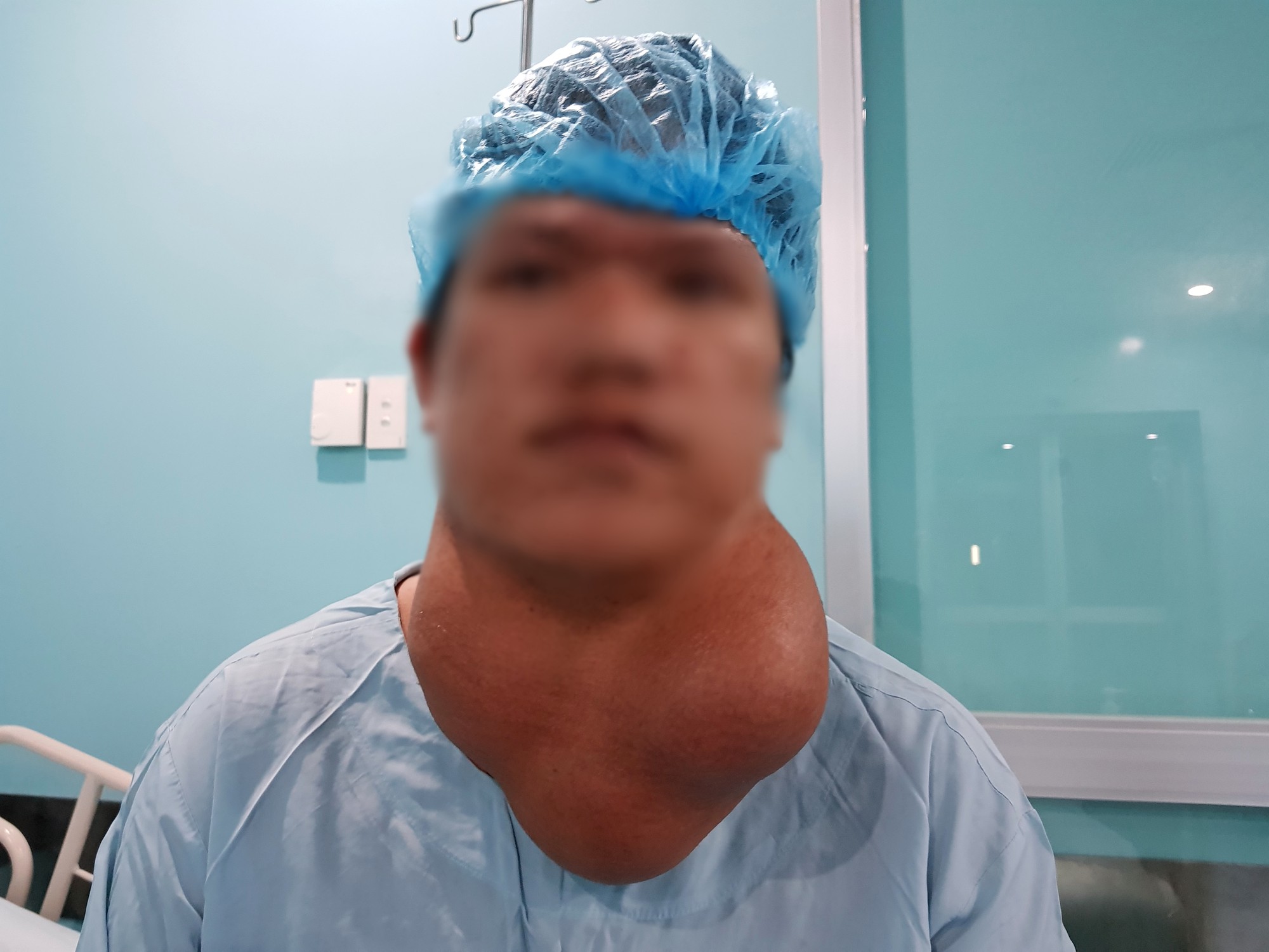 6 giờ phẫu thuật cắt bỏ khối bướu “khổng lồ” nặng 2 kg khỏi cổ người đàn ông - Ảnh 1. 6 giờ phẫu thuật cắt bỏ khối bướu “khổng lồ” nặng 2 kg khỏi cổ người đàn ông - Ảnh 1.