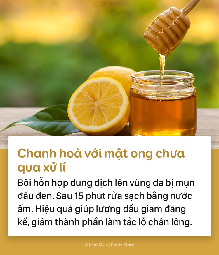 Học ngay những cách sau để xoá đi mụn đầu đen xấu xí lấm tấm trên gương mặt - Ảnh 9.