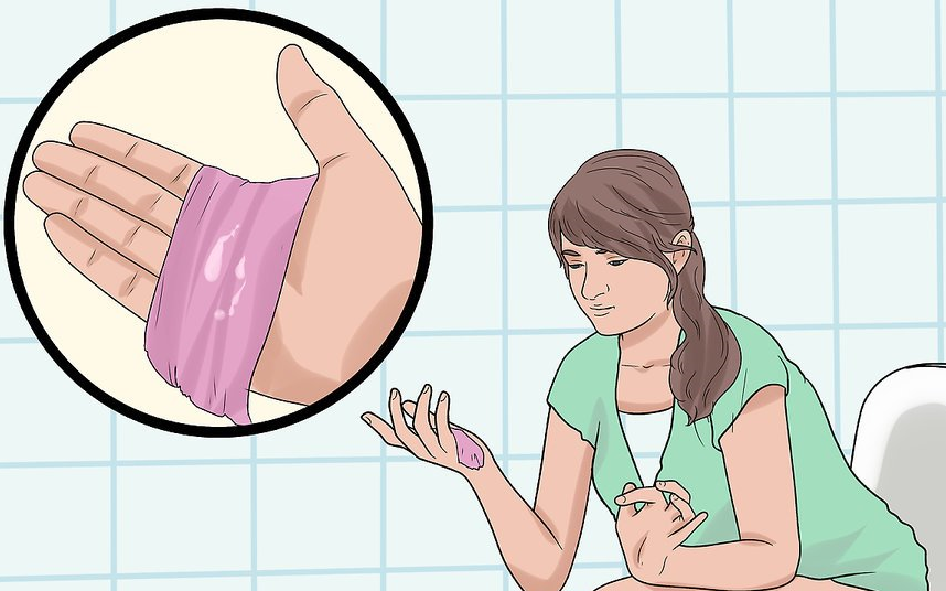 Vùng kín có mùi khó ngửi đang ngầm cảnh báo một số vấn đề sức khỏe mà bạn có nguy cơ gặp phải - Ảnh 2. Vùng kín có mùi khó ngửi đang ngầm cảnh báo một số vấn đề sức khỏe mà bạn có nguy cơ gặp phải - Ảnh 2.