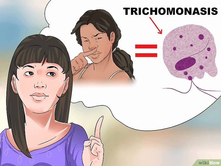 Vùng kín có mùi khó ngửi đang ngầm cảnh báo một số vấn đề sức khỏe mà bạn có nguy cơ gặp phải - Ảnh 4. Vùng kín có mùi khó ngửi đang ngầm cảnh báo một số vấn đề sức khỏe mà bạn có nguy cơ gặp phải - Ảnh 4.