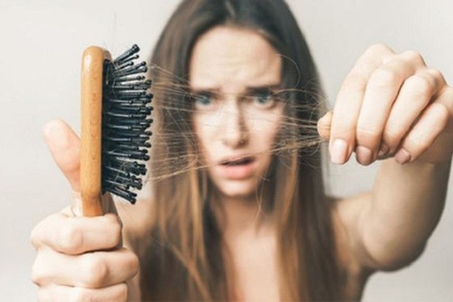 Thoát khỏi tình trạng vuốt tóc thôi cũng ra cả búi với 6 loại dầu gội ngăn rụng tóc được các chuyên gia đánh giá rất cao trên Amazon - Ảnh 1.