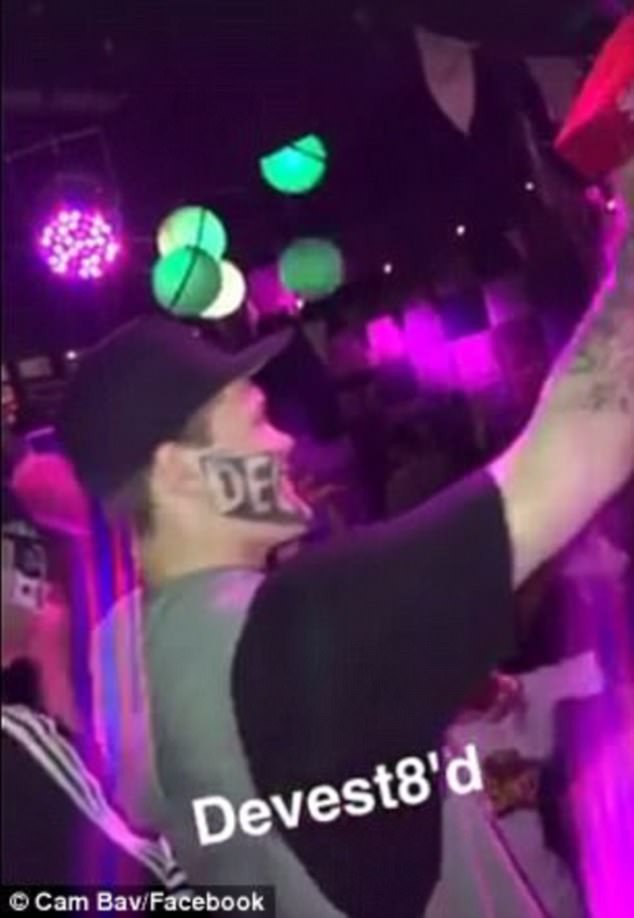 Một phút bốc đồng, ngàn năm bốc hỏa: Những thanh niên say xỉn, tỉnh dậy đã có ngay hình xăm trên mặt làm xuống dốc cả cuộc đời - Ảnh 4. Một phút bốc đồng, ngàn năm bốc hỏa: Những thanh niên say xỉn, tỉnh dậy đã có ngay hình xăm trên mặt làm xuống dốc cả cuộc đời - Ảnh 4.