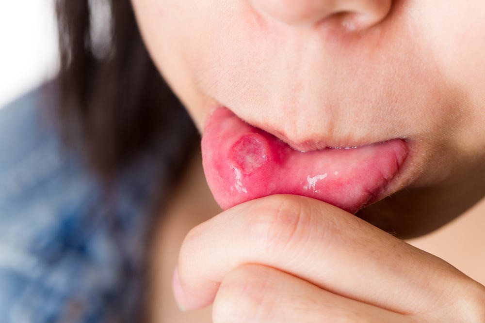 Da bị viêm đỏ, bụng căng phồng, lưỡi trắng toát... đều là những dấu hiệu sức khỏe mà bạn không nên xem thường - Ảnh 5. Da bị viêm đỏ, bụng căng phồng, lưỡi trắng toát... đều là những dấu hiệu sức khỏe mà bạn không nên xem thường - Ảnh 5.