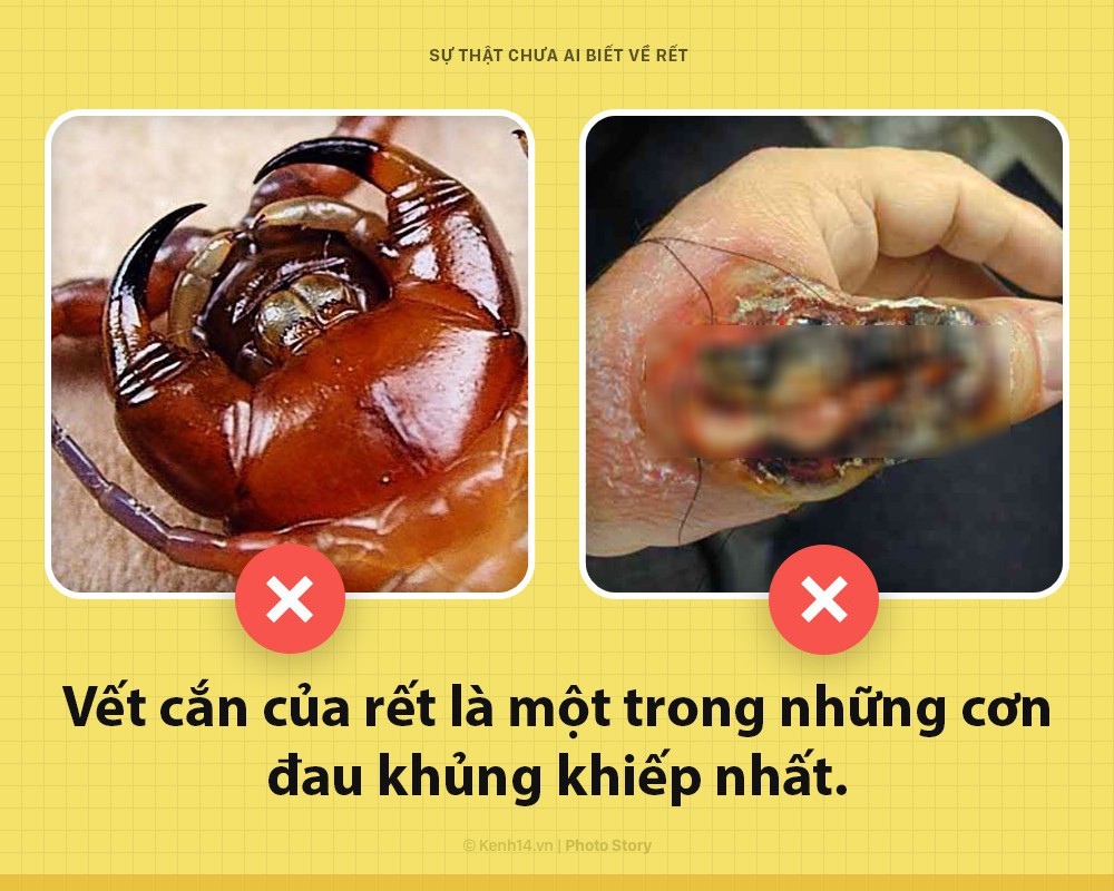 Xin ch&agrave;o! T&ocirc;i l&agrave; rết khổng lồ v&agrave; đ&acirc;y l&agrave; những sự thật chưa từng c&oacute; ai biết về t&ocirc;i - Ảnh 3.